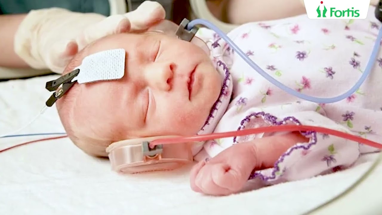 Early Detection Can Change Lives: Expert Insights on Managing Newborn Hearing Loss