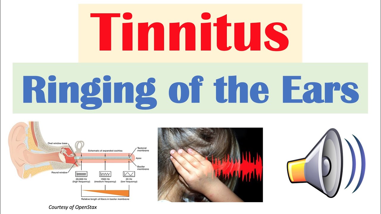 Iron Deficiency Cause Ringing In Ears at Kate Wardill blog