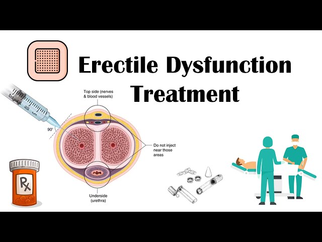 How To Treat Erectile Dysfunction? Treatment Of Erectile Dysfunction [f5ff08]